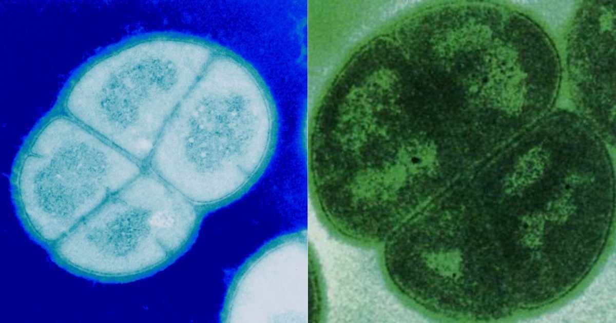 Deinococcus radiodurans – रेडिएशन से जंग जीतने वाला पृथ्वी का अमर बैक्टीरिया